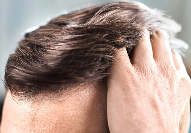 Hvordan sikrer du en smuk og sund hovedbund?