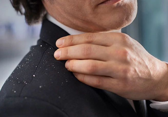 Hvordan kommer du af med skæl?